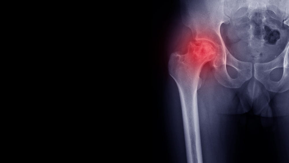 shutterstock_1537934720