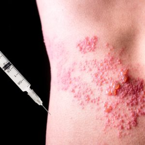 feature-image-e1512457124620