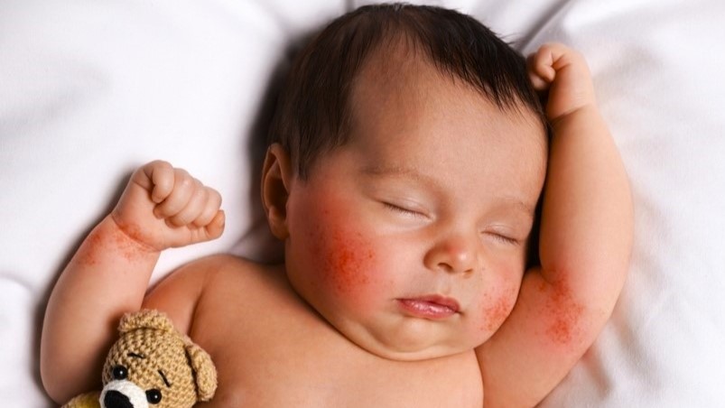 shutterstock_2264996813