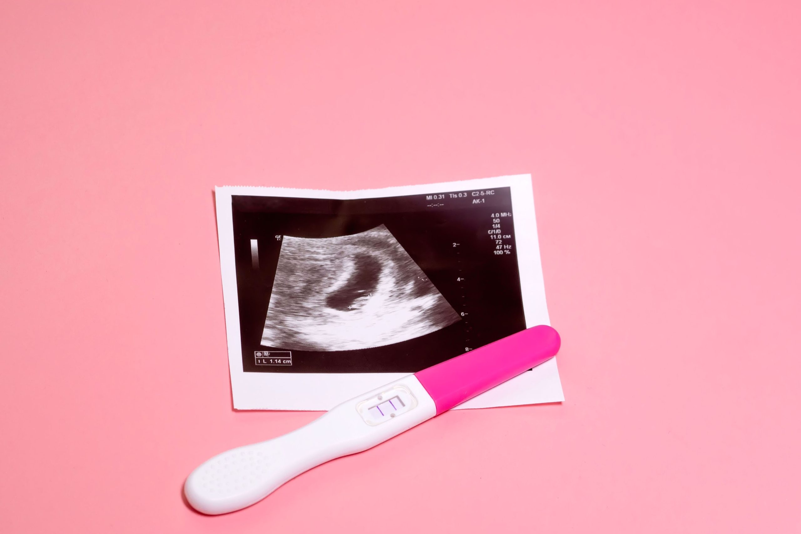 Photo,Of,Ultrasound,And,Pregnancy,Test,On,A,Pastel,Pink