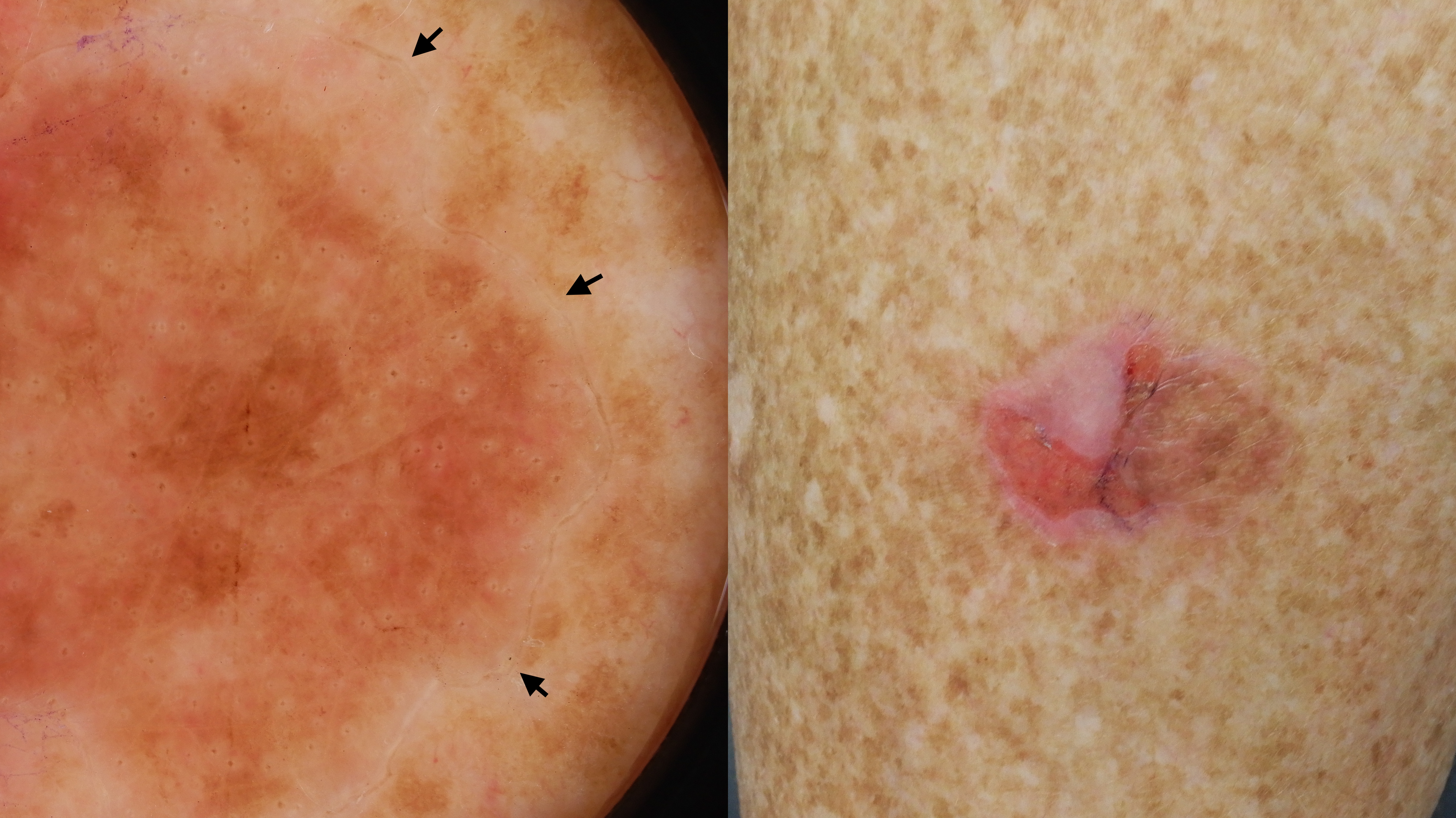 Combined clinical quick quiz