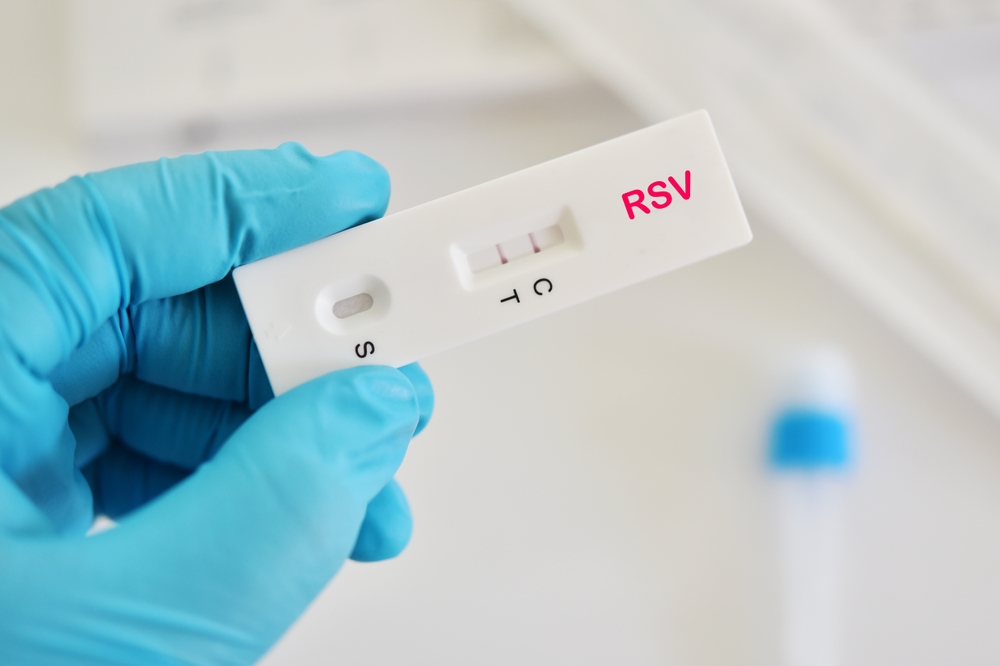 Rsv,Positive,Test,Result,By,Using,Respiratory,Syncytial,Virus,(rsv)