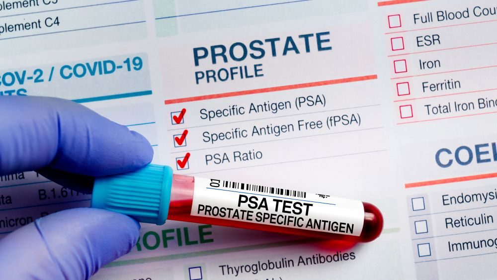 PSA testing course image