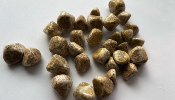 Article Feature Image - Gallstones