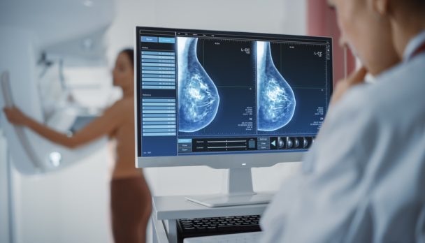 Computer,Screen,In,Hospital,Radiology,Room:,Beautiful,Multiethnic,Adult,Woman