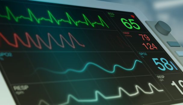 ECG_QT