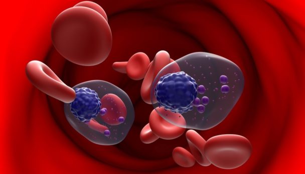 Myeloma blood cells