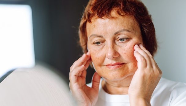 Rethinking photodamage Skin health, inflammaging and cancer prevention