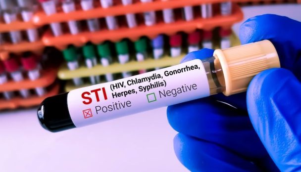 STIs_Hero image