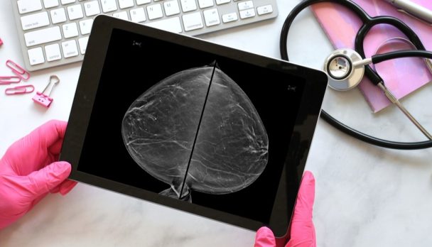 WH Breast Cancer 31022026 C Mak