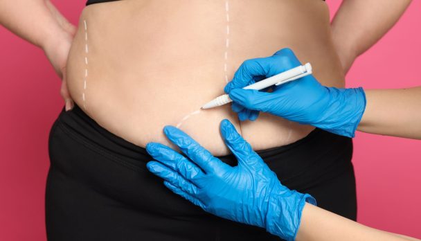 body contouring dusseldorf 20260318