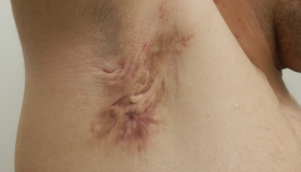 derm quiz 1