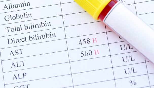 Abnormal,High,Liver,Enzyme,Test,Result,With,Blood,Sample,Tube