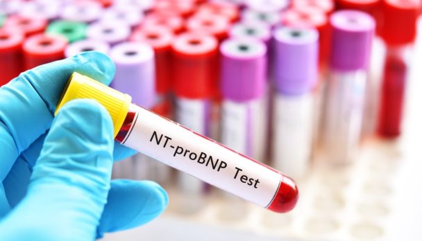 shutterstock_1215457003