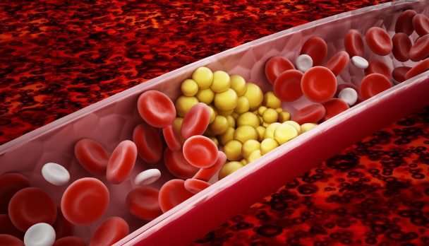 shutterstock_1341851594