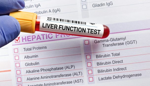 Blood,Sample,Tube,For,Analysis,Of,Lft,Liver,Function,Test.