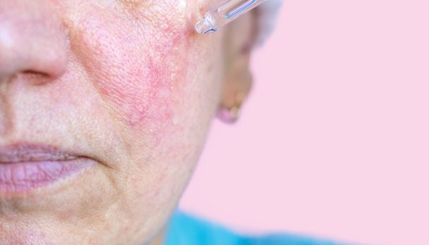 Elder,Senior,Lady,After,50,Years,Old,Woman,Doing,Facial