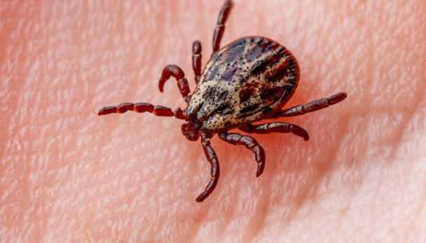 Infectious,Encephalitis,Tick,Insect,On,Skin.,Encephalitis,Virus,Or,Lyme