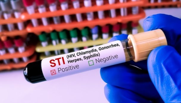 Biochemist,Or,Lab,Technologist,Holds,Blood,Sample,For,Sti,Or