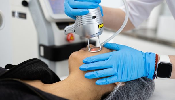 Fractional,Laser,Co2,Procedure.,Cosmetic,Treatment,In,Beauty,Clinic.,Woman